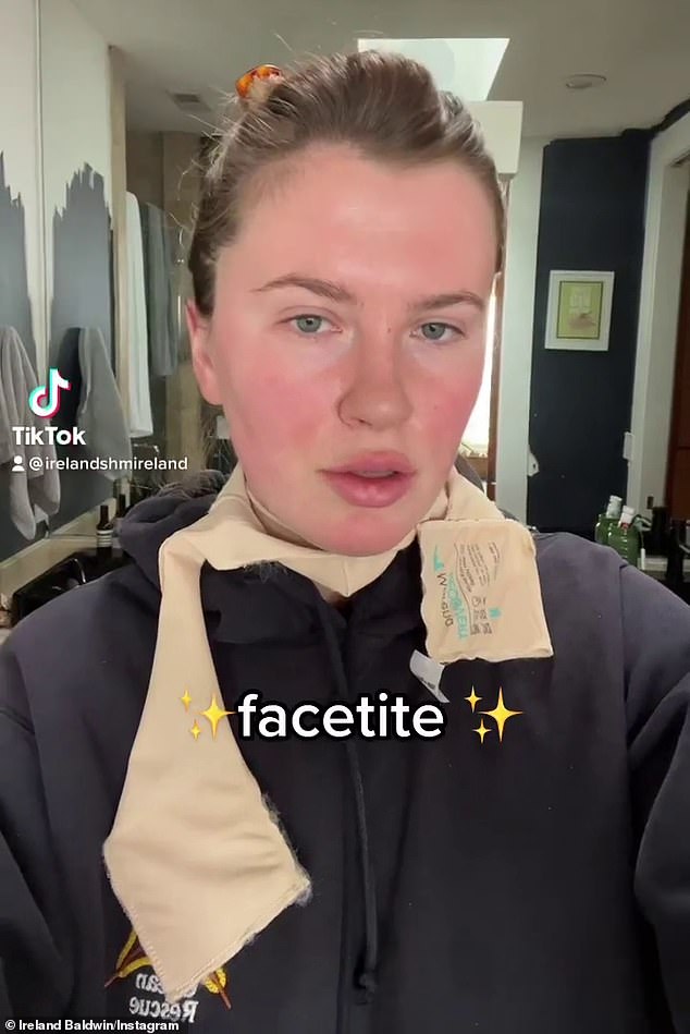 صادقة: إيرلندا بالدوين تتكلم عن سبب خضوعها لعملية FaceTite ، وهو إجراء تجميلي ضئيل يمكن مقارنته بعملية شد الوجه الجراحية ، هذا الشهر